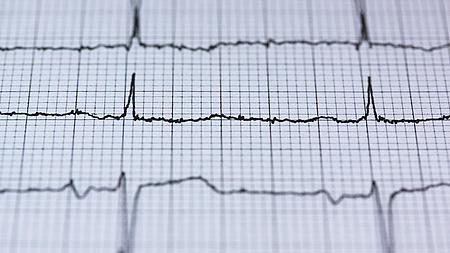 Auf einem Blatt Papier ist eine EKG-Aufzeichnung einer Herzfrequenz zu sehen.
