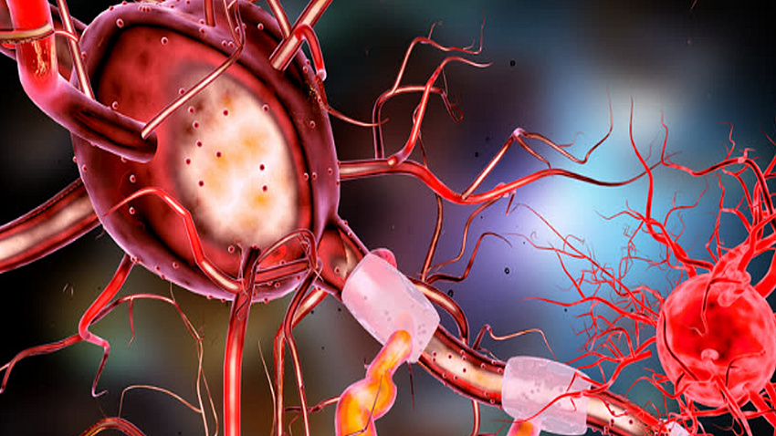 Abbildung einer Nervenzelle (Bildquelle: Irfan Ullah auf Pixabay)